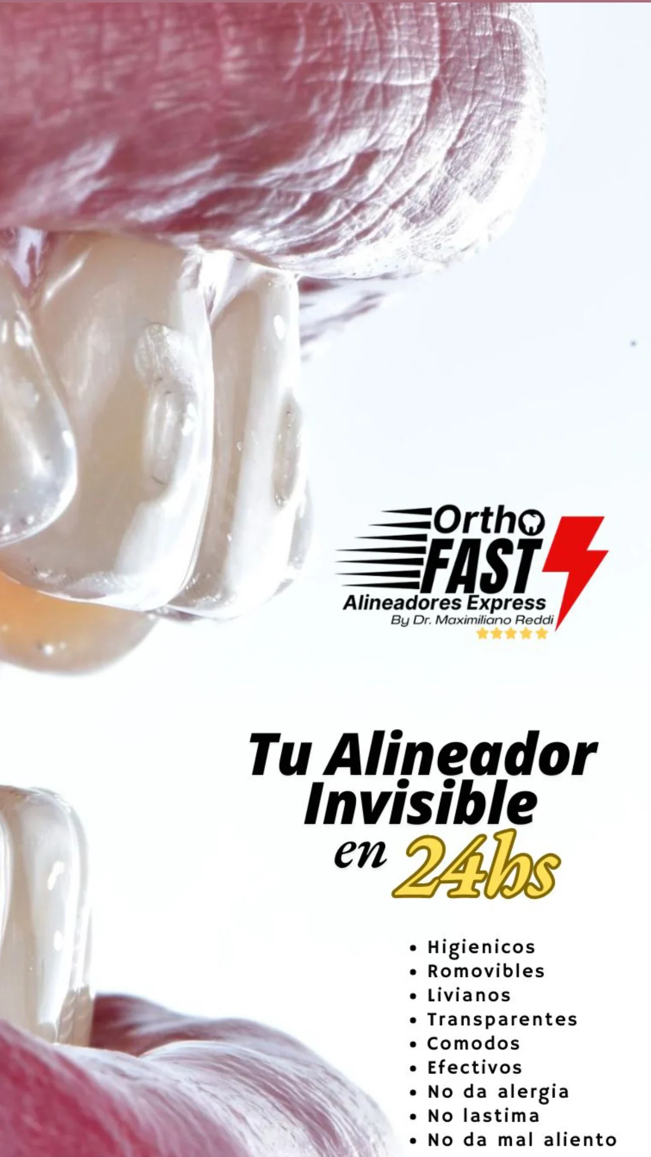 ortodoncia invisible