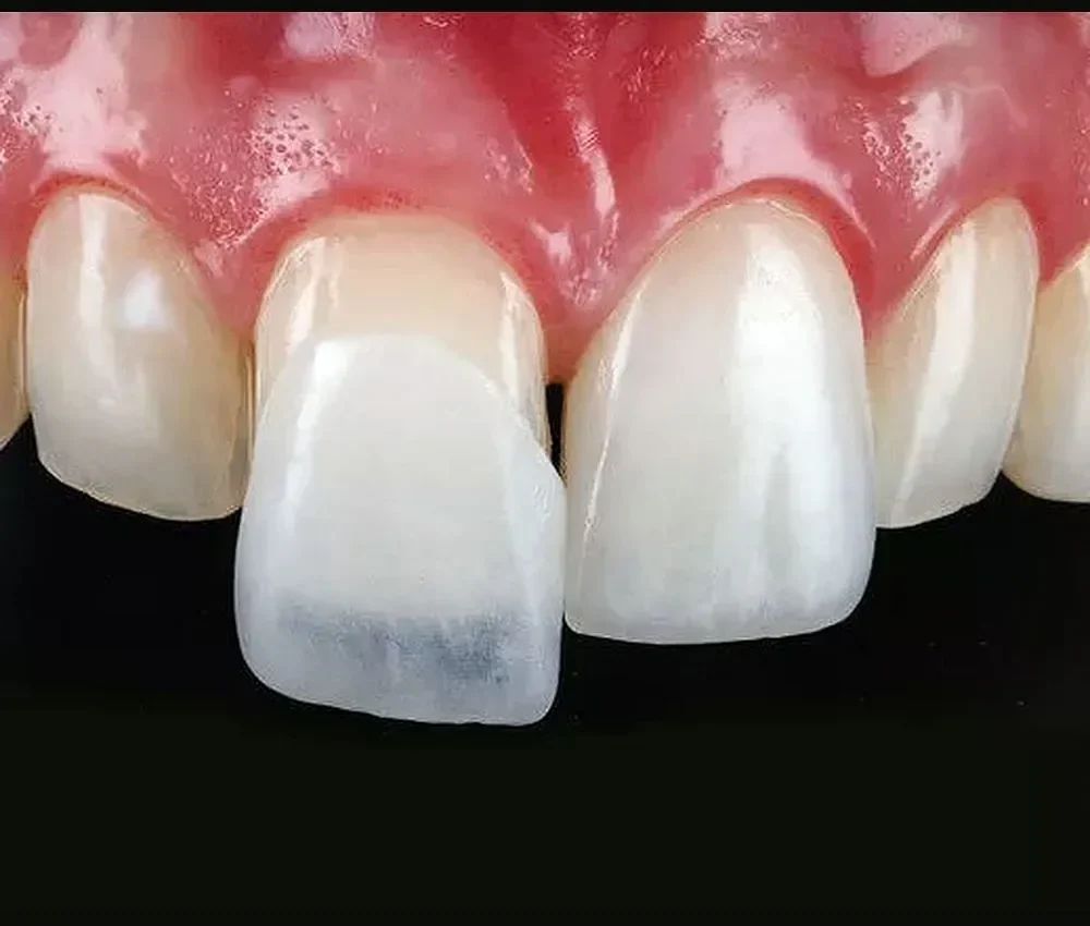 clinica estetica dental en barcelona