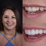 tratamientos dentales en barcelona