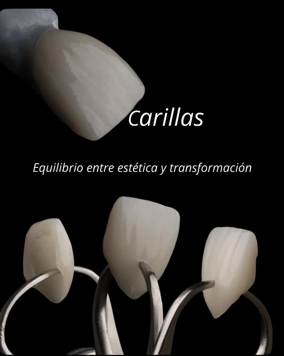 Carillas dentales y guía de color