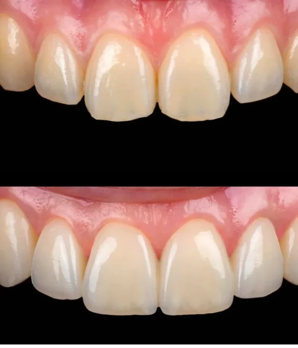 estetica dental barcelona